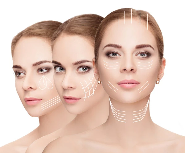 Microneedling bij HYALVOMED in Keulen en Aken